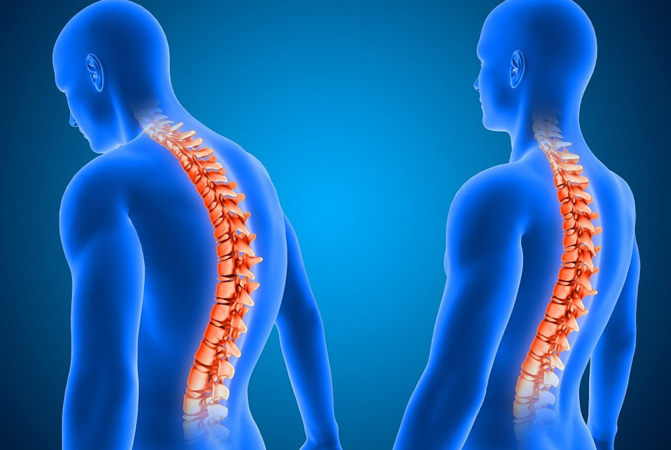 Spine problems: prevention and treatment