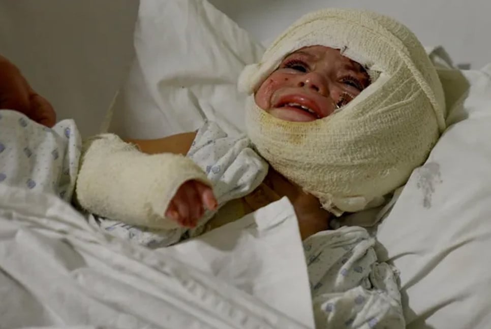 Father recounts how daughter’s skin, flesh melted by Israeli missile