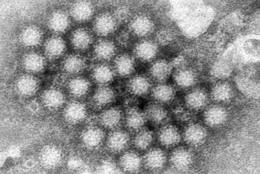 Norovirus cases are surging in parts of the US