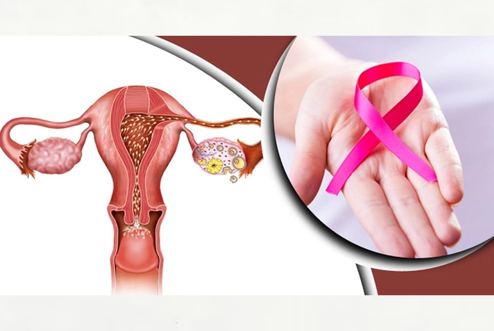 4,971 women die of cervical cancer annually