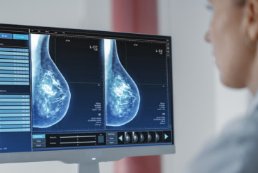 New AI method improves early breast cancer detection