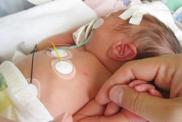 Congenital heart disease: A defect in newborns