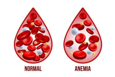 Dizziness could signal anaemia: Causes, symptoms, and treatment