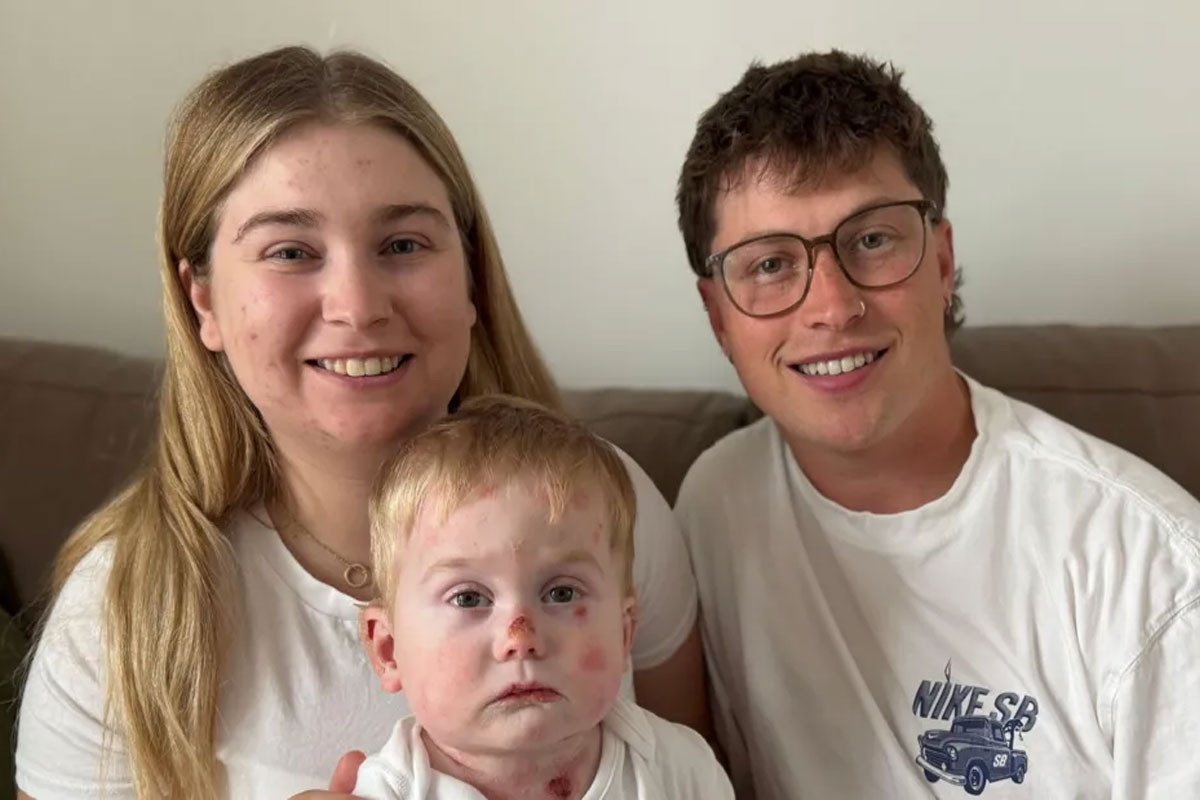 “Our son’s skin could tear from a cuddle”: Parents share life with rare genetic disorder