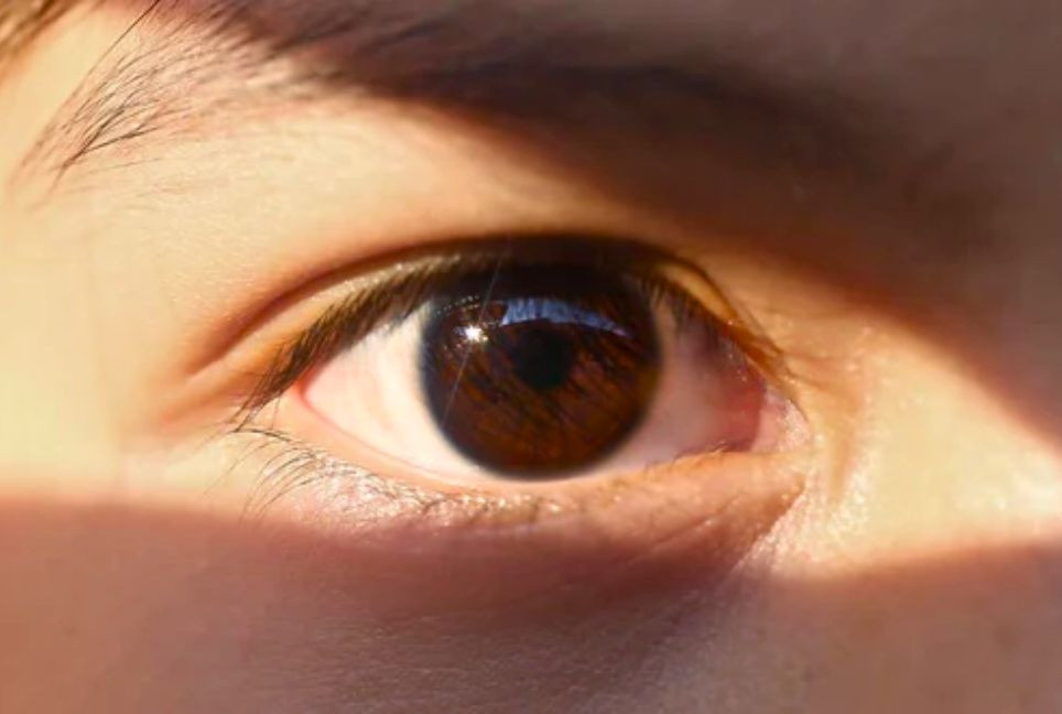 Excessive UV exposure can cause serious eye diseases
