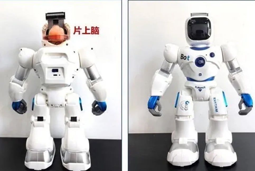 China develops robot to implant hair-thin brain electrodes