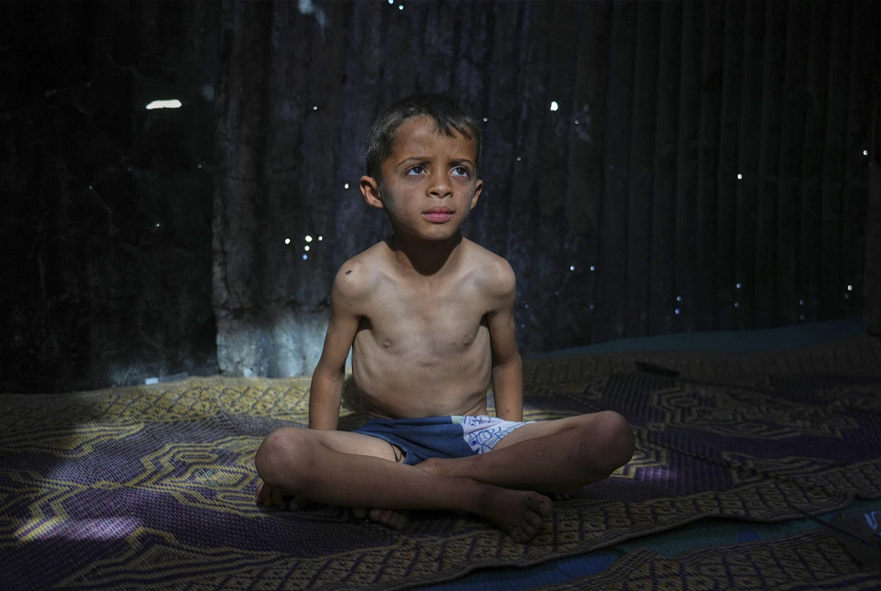Hunger, malnutrition rises across Gaza as Israel's blockade leaves mothers with few options