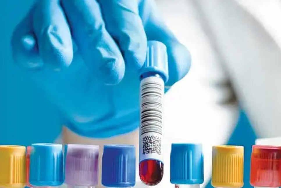 U.S. approves first blood test for Alzheimer’s detection