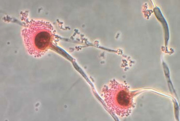 Common fungi might eat people as global heat rises