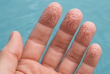 Why do fingers wrinkle in water?