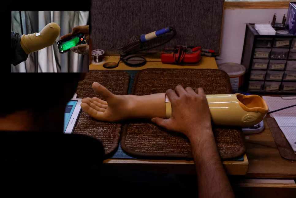 From Karachi to Gaza: Pakistani startup ships prosthetics to child war survivors