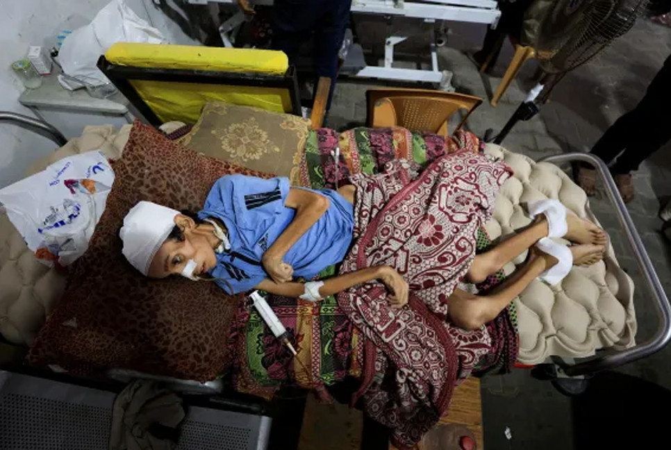 15 more die of hunger in Gaza, toll hits 101