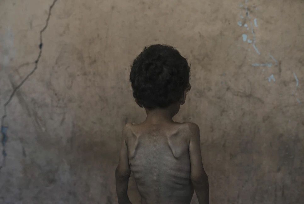 Netanyahu claims no one in Gaza is starving