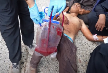Gaza faces dire blood shortage as war and starvation intensify