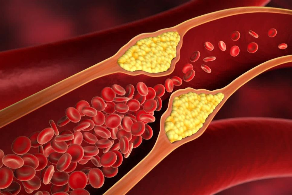 Cardiologist debunks biggest myth about cholesterol