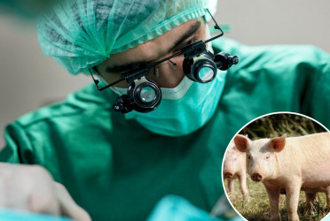 Pig lung transplanted into a person in world first