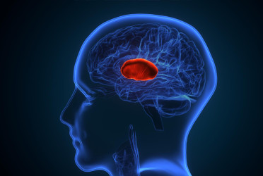 Blurry vision could be a hidden sign of a brain tumour, expert warns