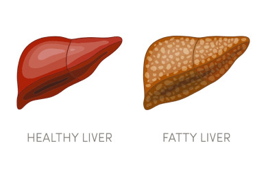 A secret to prevent fatty liver disease