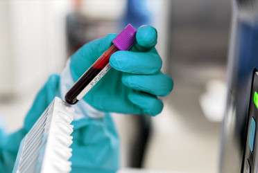 New blood test detects over 50 types of cancer in early stages