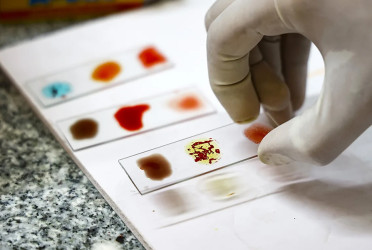 The magic of the world's rarest blood type