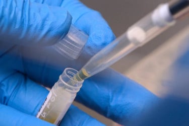 NIH funding cuts disrupt over 74,000 clinical trial participants, report finds