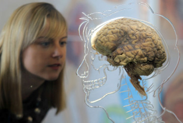 US physician shares 'secret hack to literally grow your brain even as an adult’
