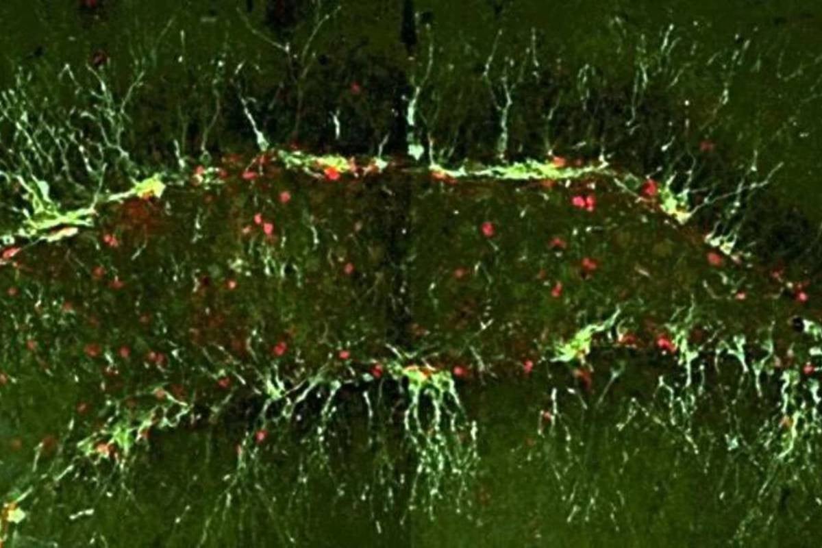 Japanese researchers improve cognitive function in Alzheimer’s mice study