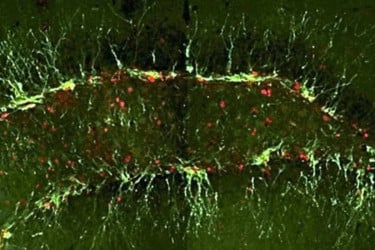 Japanese researchers improve cognitive function in Alzheimer’s mice study