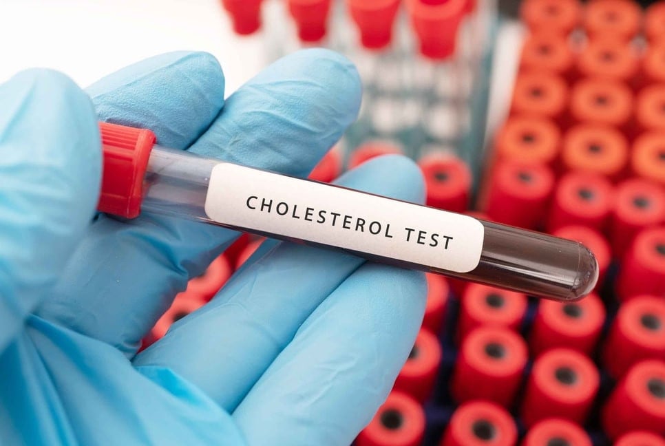 When should you start cholesterol testing?