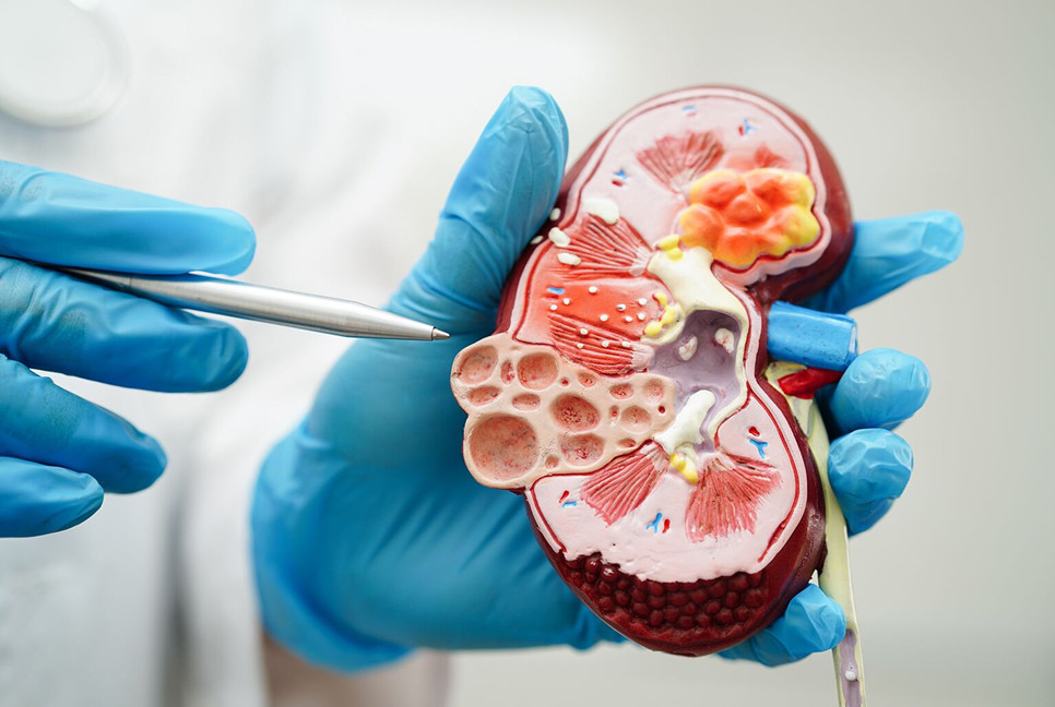 Everyday symptoms that may point to kidney disease