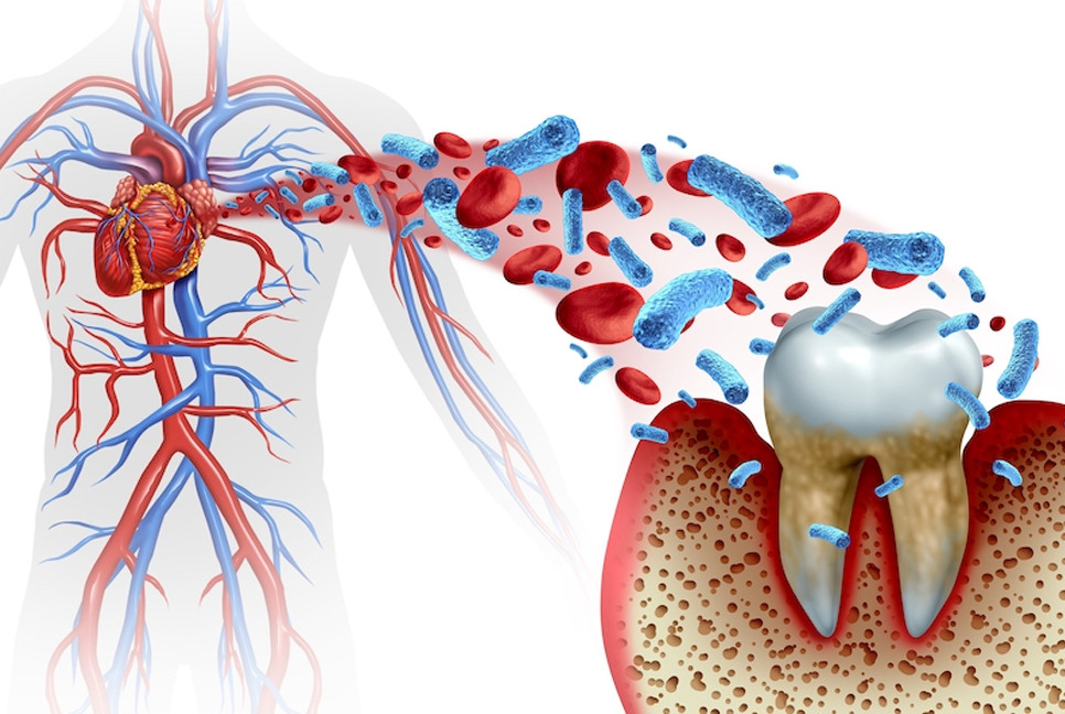 One simple oral health habit that add years to life