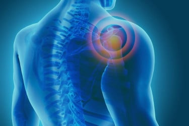 Study finds unequal access to chronic pain rehabilitation
