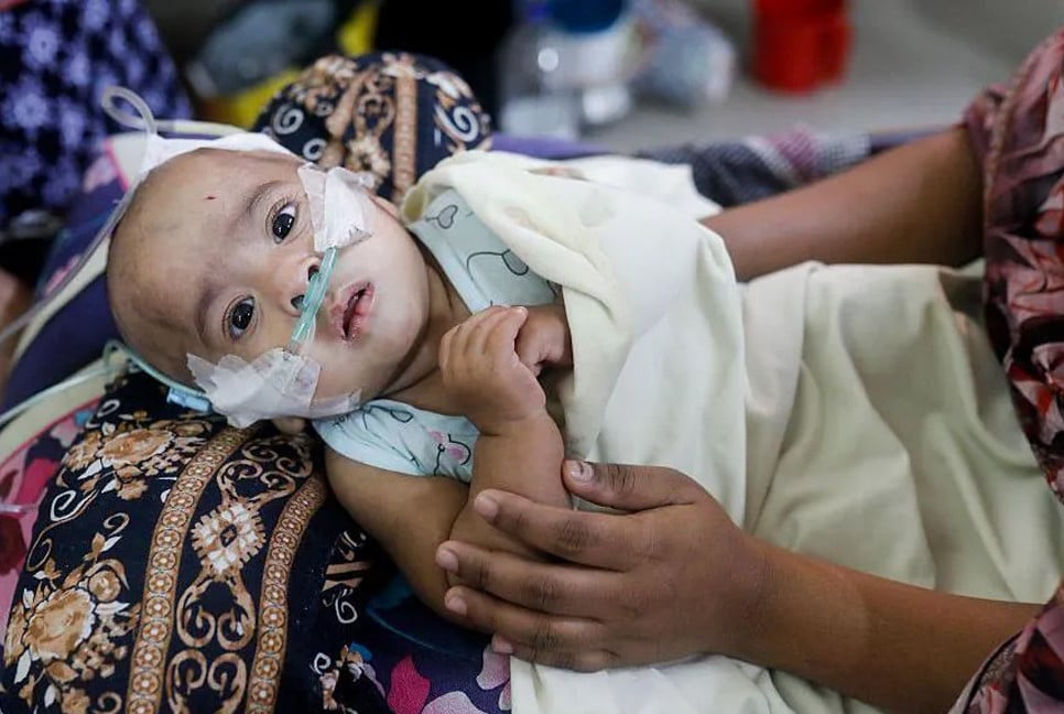 7 more child deaths push measles toll to 709
