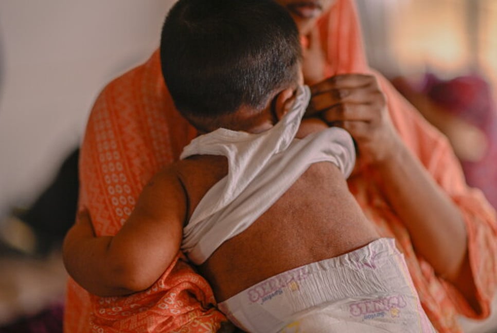 5 children die from measles symptoms in 24 hours